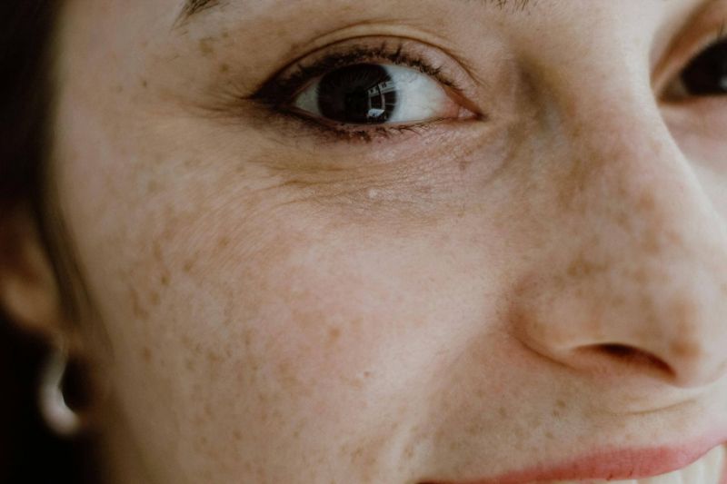 Macchie viso: gli attivi K-beauty che funzionano davvero